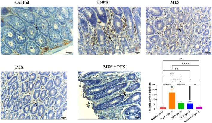 Colo-Protective Effects of Pentoxifylline Alone or in Combination With Mesalamine in Colitis Through Sphingosine Kinase 1/Sphingosine 1 Phosphate, and Zonula Occuldin 1 Pathways: New Molecular Approach.