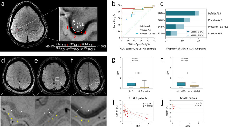 Diagnostic value of the motor band sign in amyotrophic lateral sclerosis: a 7T magnetic resonance imaging study.
