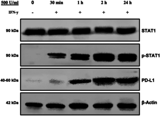 Curcumin inhibits IFN-γ induced PD-L1 expression via reduction of STAT1 Phosphorylation in A549 non-small cell lung cancer cells.