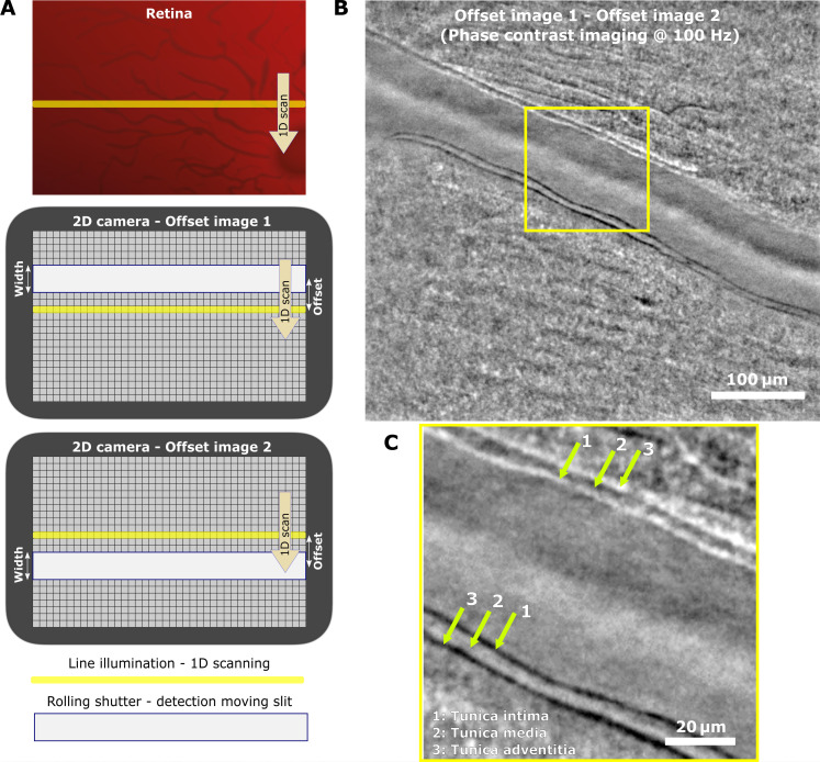 Revealing neurovascular coupling at a high spatial and temporal resolution in the living human retina.