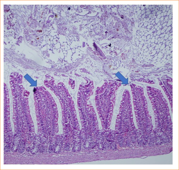 Protective role of pinocembrin in a rat model of intestinal ischemia-reperfusion injury.