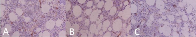 Prognosis of multiple myeloma patients based on histopathological evaluation of bone marrow.