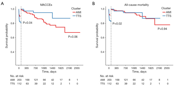 Comparison of clinical features and outcomes of Chinese patients with Takotsubo syndrome and acute myocardial infarction-results from the first Chinese Takotsubo syndrome registry.