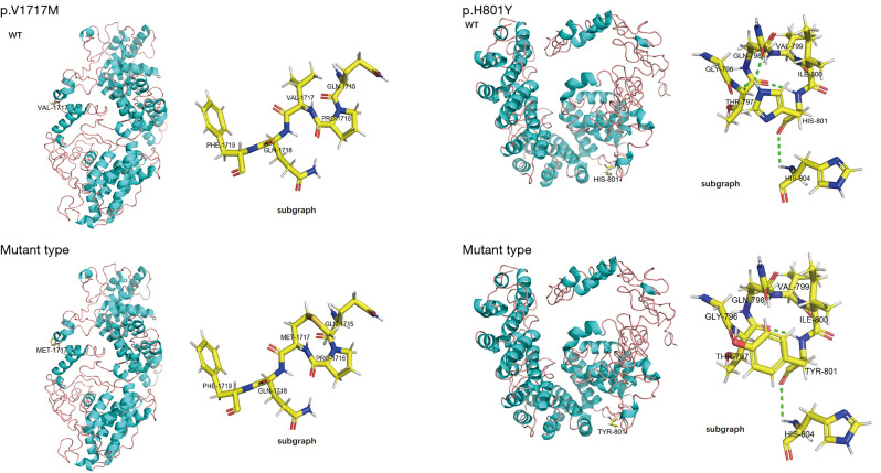 Loss-of-function of lipopolysaccharide-responsive beige-like anchor protein causes inflammatory bowel disease-a case report and literature review.