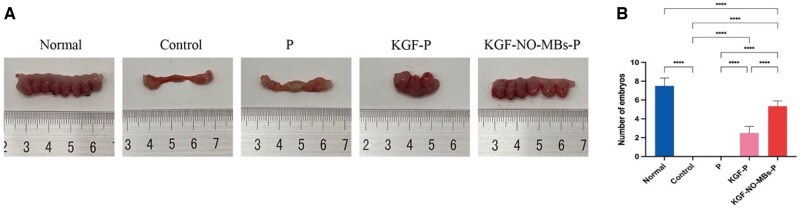 Two-in-one: multifunctional poloxamer hydrogel accelerates endometrial regeneration and fertility restoration through synergistic regulation of KGF-2 and NO.