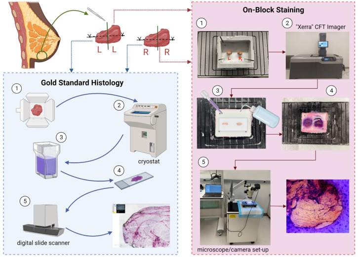 Development of an H&E on-block staining technique for collagen detection in cryo-fluorescence tomography imaging of frozen breast tissue samples.