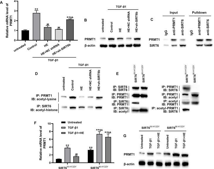 Hederagenin promotes SIRT6 to attenuate epidural scar formation by aggravating PRMT1 deacetylation.