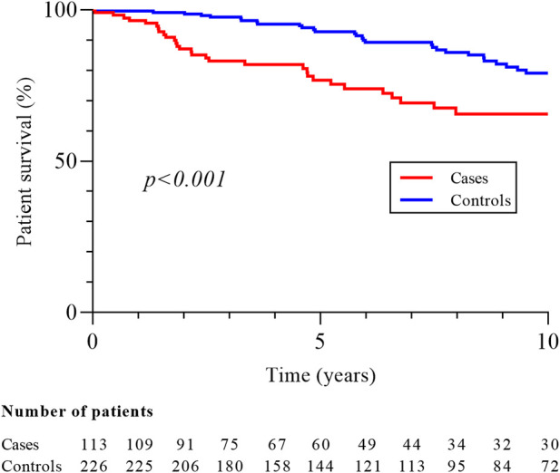 Renal Cell Carcinoma in Native Kidney After Kidney Transplantation: A Multicenter Case Control Study With a Focus on Screening Strategy.
