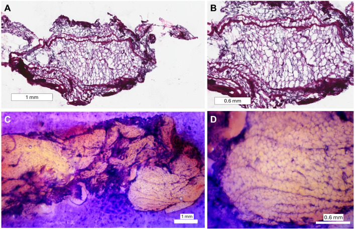 Development of an H&E on-block staining technique for collagen detection in cryo-fluorescence tomography imaging of frozen breast tissue samples.