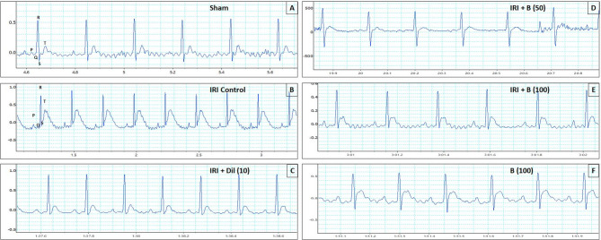 Bisacurone ameliorates myocardial ischemia/reperfusion injury in rats: regulation of inflammatory and apoptosis pathways via CHOP/GRP78 proteins.