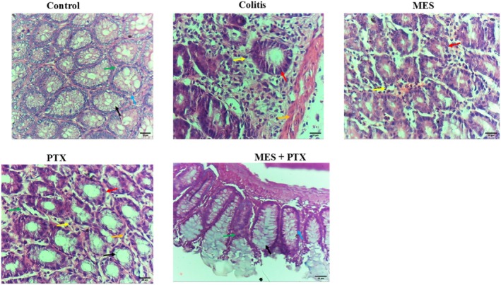 Colo-Protective Effects of Pentoxifylline Alone or in Combination With Mesalamine in Colitis Through Sphingosine Kinase 1/Sphingosine 1 Phosphate, and Zonula Occuldin 1 Pathways: New Molecular Approach.