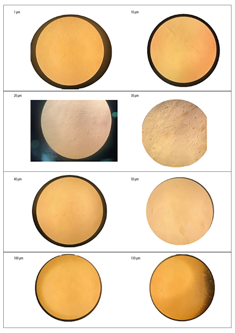Efficacy of Different Concentrations of Melatonin on Cultured Human Periodontal Ligament Stem Cells.
