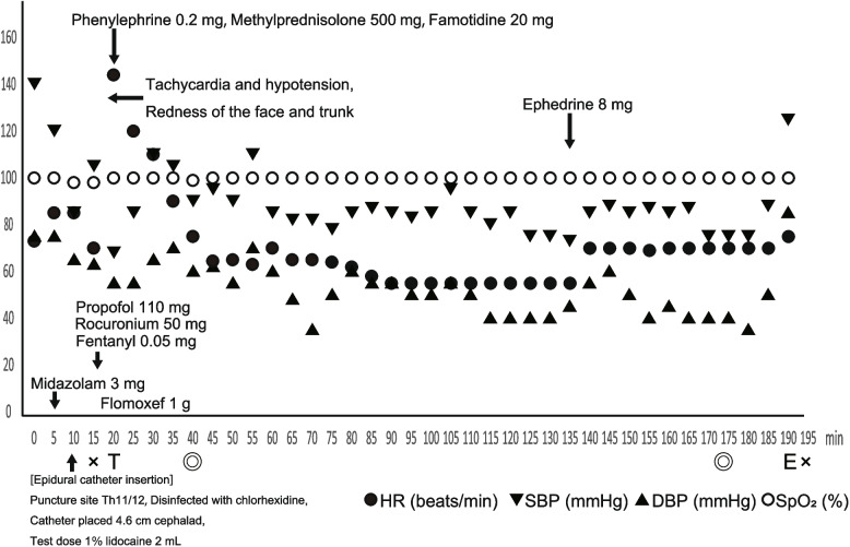 Anaphylaxis due to midazolam administered before induction of general anesthesia: a case report.