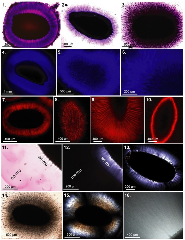 How to Test for Seed Mucilage to Examine an Age-Old Question: A Response to Ladwig and Lucas (2024).