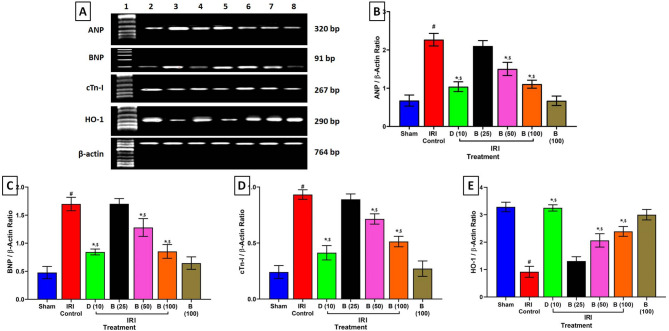Bisacurone ameliorates myocardial ischemia/reperfusion injury in rats: regulation of inflammatory and apoptosis pathways via CHOP/GRP78 proteins.