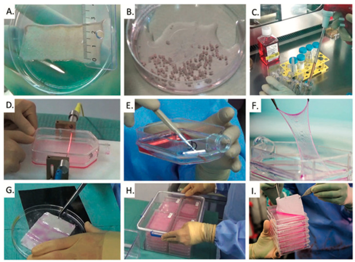 Laboratory-Generated Autologous Skin Substitutes for Burn Treatment in Europe: Narrative Review, Experts' Opinion, and Legal Considerations.