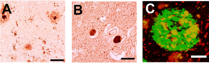Correction to: Role of Synucleins in Alzheimer's Disease.