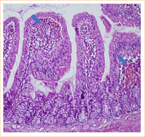 Protective role of pinocembrin in a rat model of intestinal ischemia-reperfusion injury.