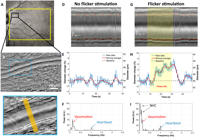 Revealing neurovascular coupling at a high spatial and temporal resolution in the living human retina.