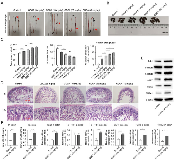 Chenodeoxycholic acid activates the TGR5/TRPA1-5-HT pathway to regulate intestinal motility in breastfed infants and mouse models.