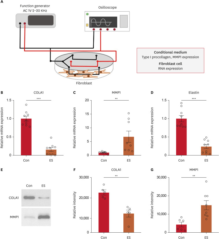 Electrical Stimulation Using a Low-Frequency and Low-Intensity Alternating Current Modulates Type I Procollagen Production and MMP-1 Expression in Dermal Fibroblasts.