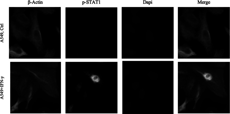 Curcumin inhibits IFN-γ induced PD-L1 expression via reduction of STAT1 Phosphorylation in A549 non-small cell lung cancer cells.