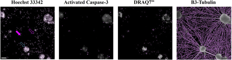 An injectable 2.5% cross-linked polyacrylamide hydrogel (2.5 iPAAG) demonstrates no neurotoxicity in human induced pluripotent stem cells-derived iCell<sup>®</sup> GlutaNeurons.