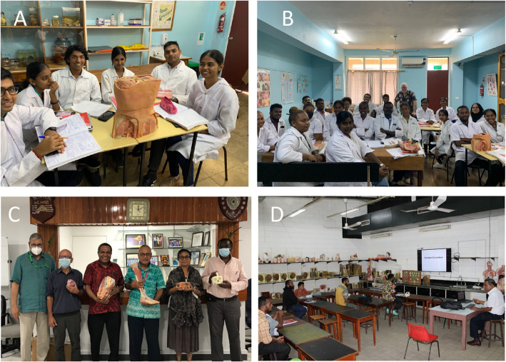 Challenges of access to cadavers in low- and middle-income countries (LMIC) for undergraduate medical teaching: a review and potential solutions in the form of 3D printed replicas.