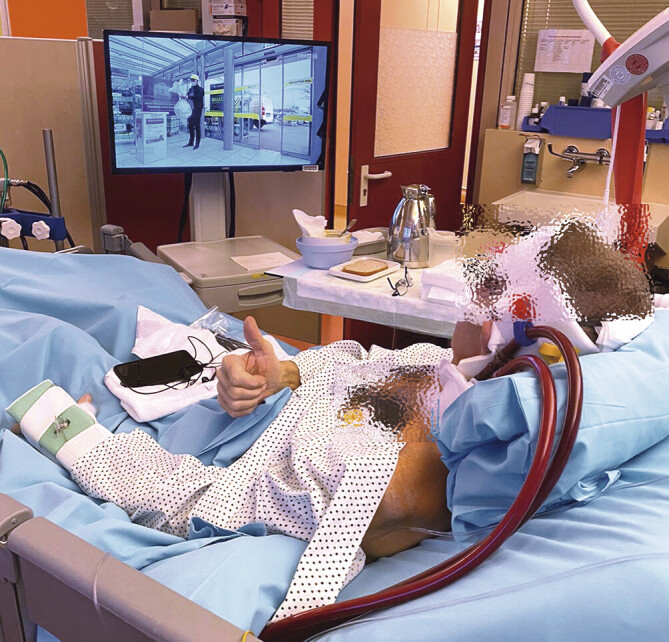 [Extracorporeal Life Support in Lung Transplantation and Beyond].