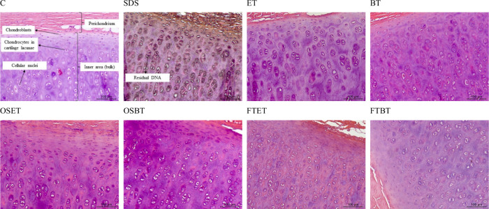 Greener Decellularization of Porcine Auricular Cartilage Using Supercritical Technology and Different Pretreatments for Application in Tissue Engineering