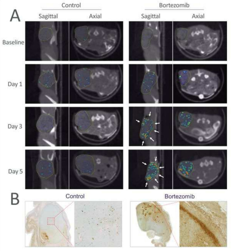 An in vivo imaging approach for simultaneously assessing tumor response and cytotoxicity-induced tissue response in chemotherapy