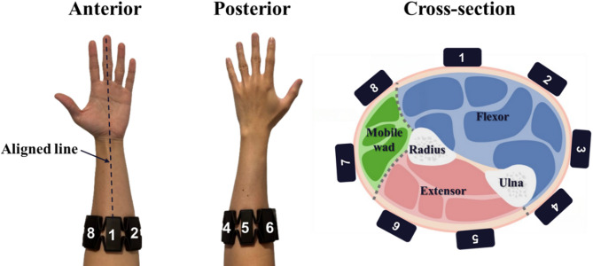 Individual muscle strengths in rehabilitation outcomes of distal radius fracture.