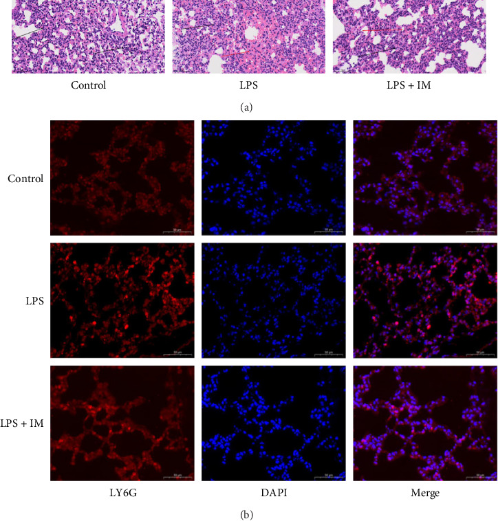 The Molecular Mechanisms of Imatinib Treatment on Acute Lung Injury in Septic Mice Through Proteomic Technology.