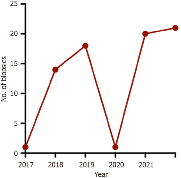 Essential role of kidney biopsy in diagnosing glomerular diseases amidst evolving biomarkers.