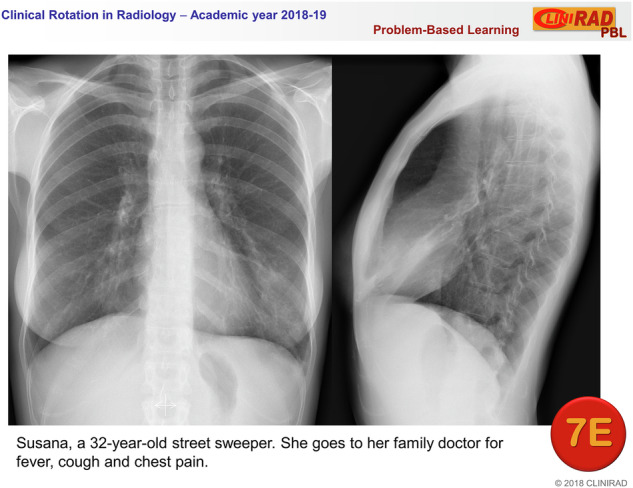 Problem-based learning in radiology achieves similar results in classroom and metaverse settings.