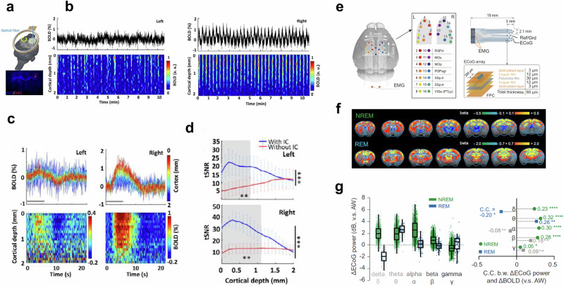 Advanced preclinical functional magnetic resonance imaging of the brain.