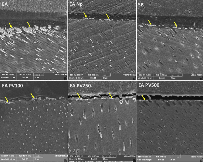 Effect of Brazilian red propolis on microtensile bond strength and sealing ability of the methacrylate-based bonding agents.