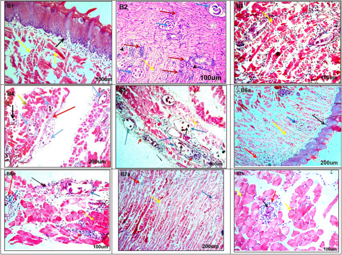 Ameliorative Effects of Blue LED Irradiated and Non-Irradiated Fenugreek Seed Extracts on Murine Trichinosis