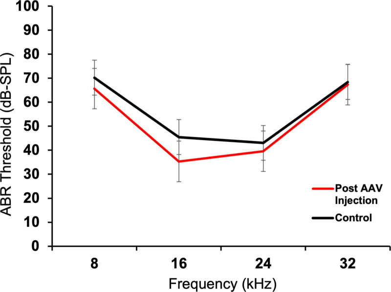 AAV-mediated transgene delivery targeting spiral ganglion nonsensory cells.