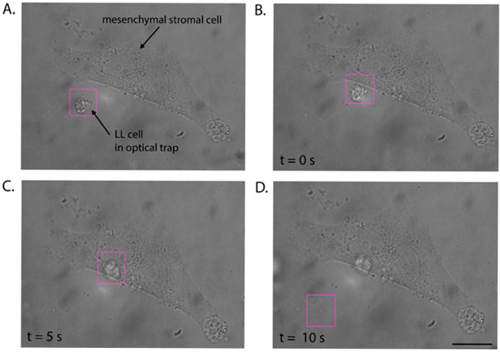 Determination of the Minimum Cell-to-Cell Adhesion Time Using Optical Tweezers in Leukemia and Lymphoma Research.