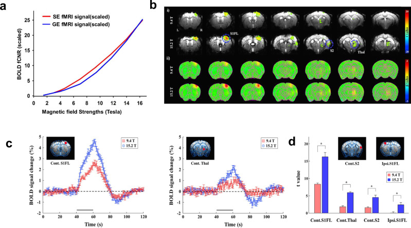 Advanced preclinical functional magnetic resonance imaging of the brain.