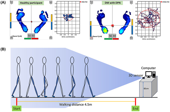 Postural sway serves as a predictive biomarker in balance and gait assessments for diabetic peripheral neuropathy screening: a community-based study.