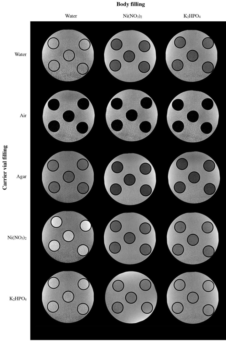 Development of a carrier device for dental-dedicated magnetic resonance imaging.