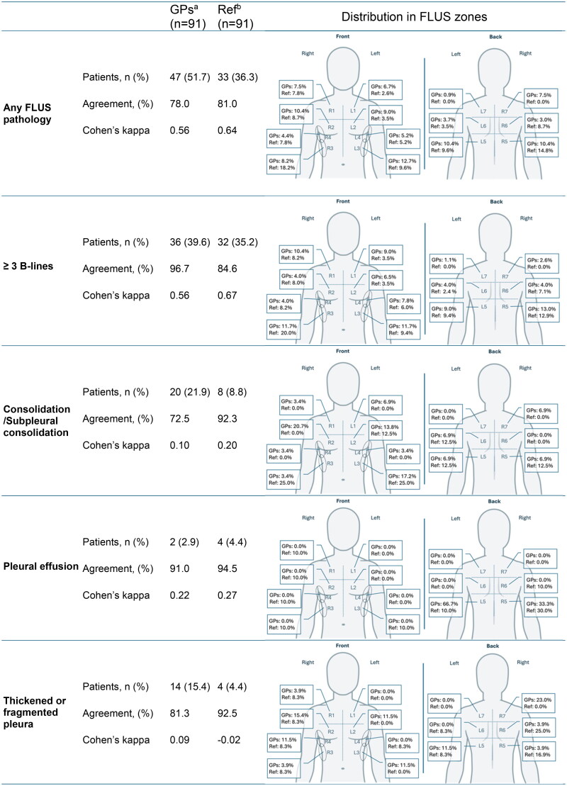 Evaluating general practitioners' focused lung ultrasound competence and findings in patients with suspected community-acquired pneumonia in general practice.