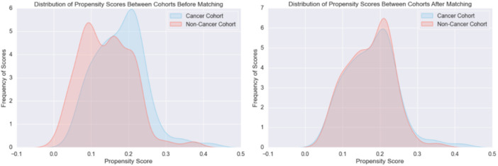 Evaluating Adverse Outcomes After Myringotomy or Tube Placement in Head and Neck Cancer.