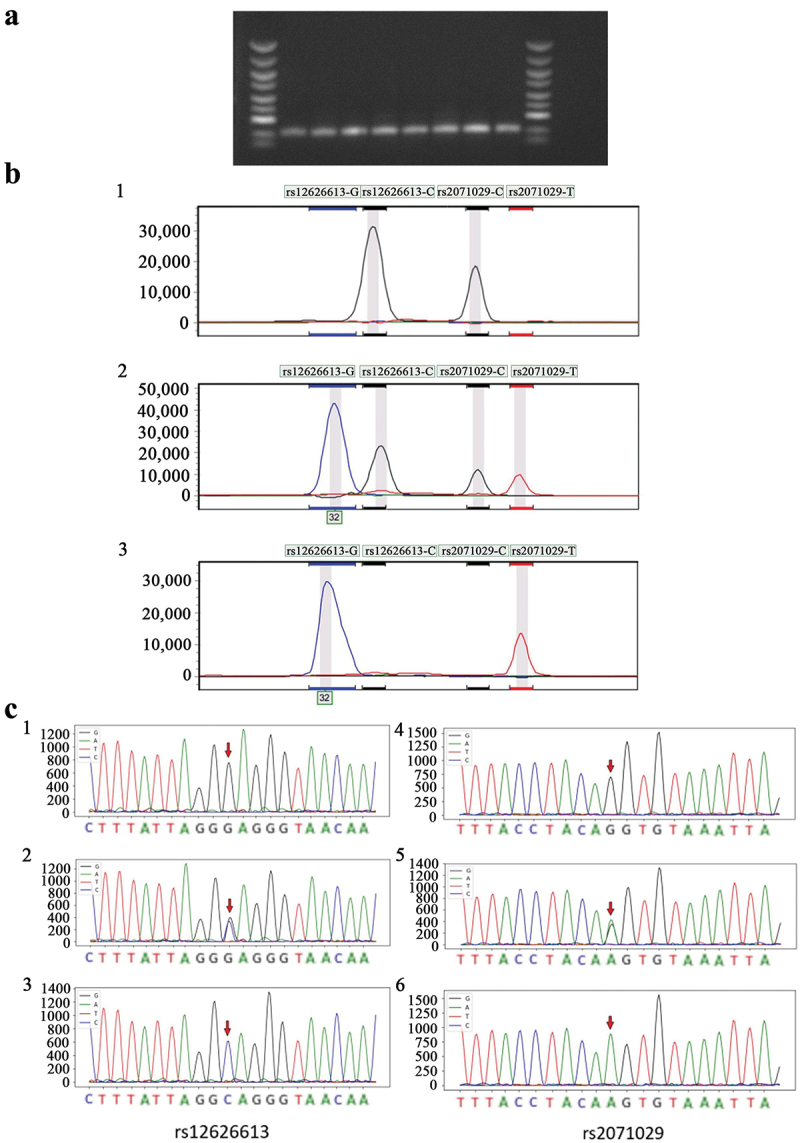 Susceptibility of RUNX1 promoter rs2071029 polymorphism to adjuvant chemotherapy-induced neutropenia in CRC.