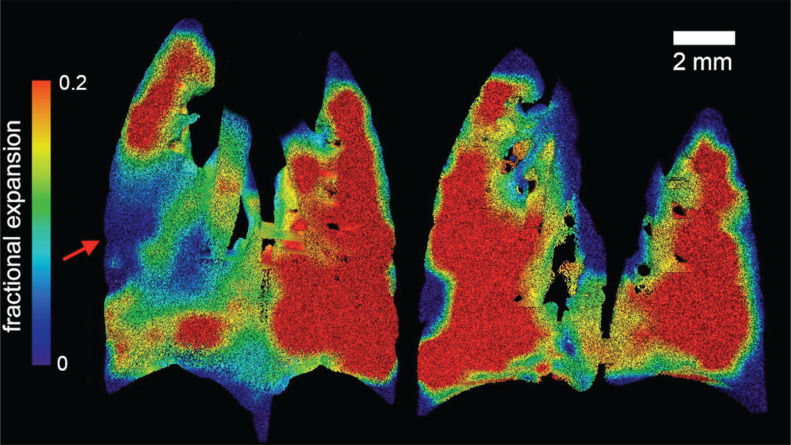 X-ray velocimetry in dynamic imaging: a systematic overview of approaches.