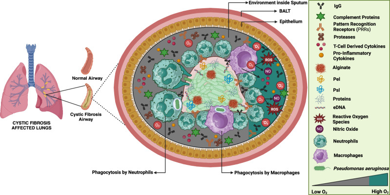 Immune system dynamics in response to Pseudomonas aeruginosa biofilms.