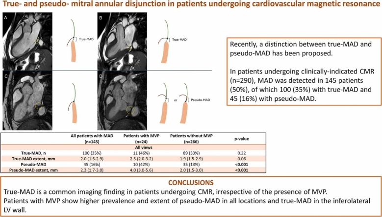 True- and pseudo-mitral annular disjunction in patients undergoing cardiovascular magnetic resonance.