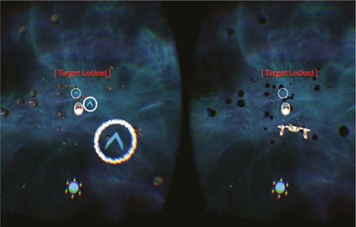 Binocular Approaches in Amblyopia Treatment Based on Dichoptic Stimulation